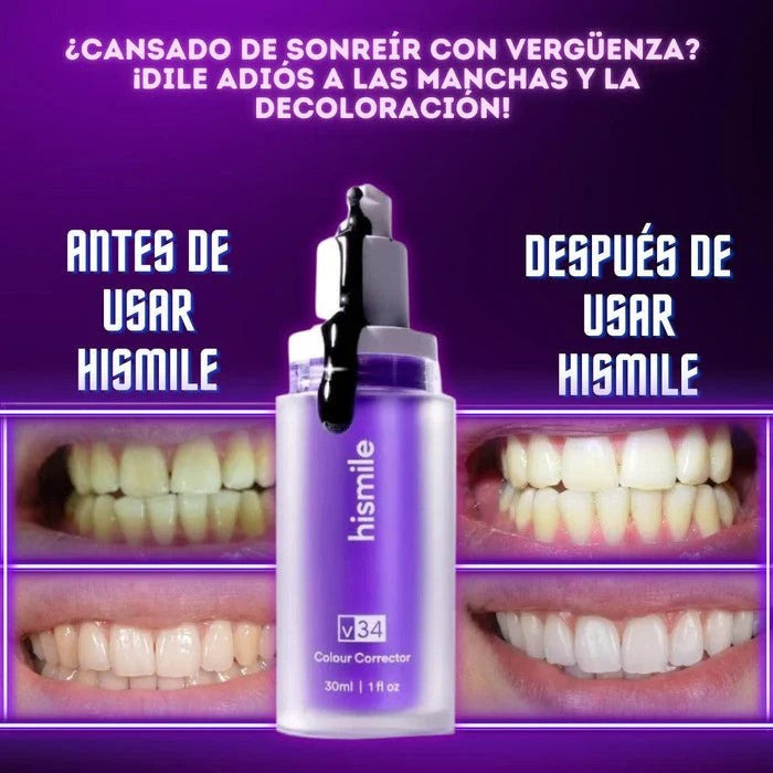 HISMILE BLANQUEADOR DENTAL V34